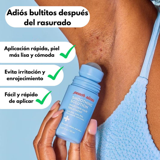 Roller Tratamiento - Pelos Encarnados - TodoBacano